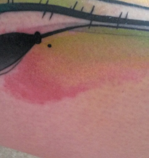 Poppy124: nach 4/5 Wochen: seltsame "Rötung" ?!?